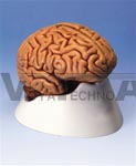 Classic Brain Model, 5 part